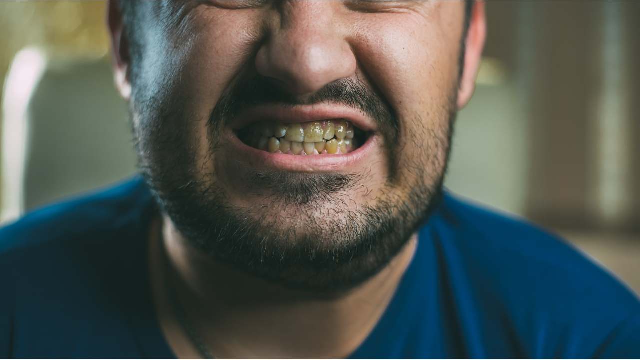 Man with dark teeth