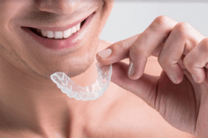 Dental-mouthguard