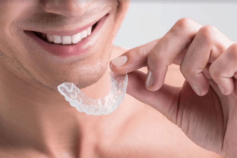 Dental mouthguard