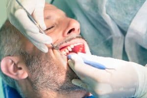Patient undergoing dental filling for cavity