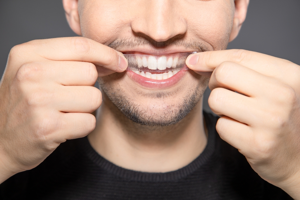 Do teeth whitening strips work?