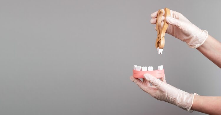 Wisdom teeth removal cost